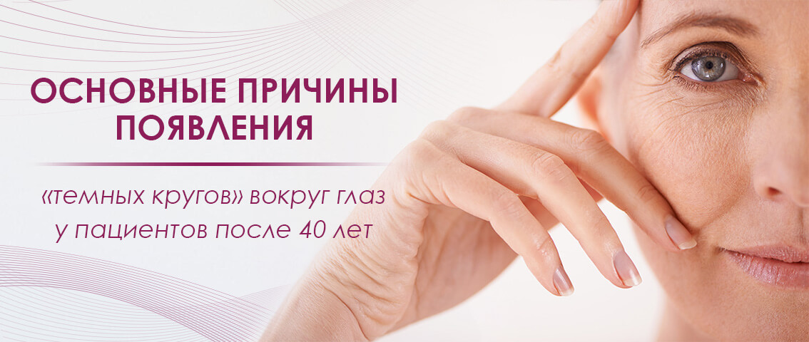 Основные причины появления «темных кругов» вокруг глаз у пациентов после 40 лет - FloSal