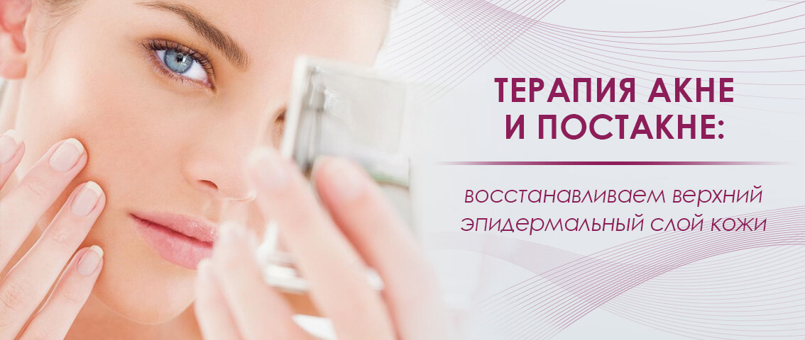 лечение акне дерматолог отзывы