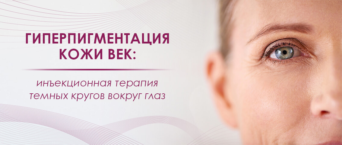 Гиперпигментация кожи век - FloSal