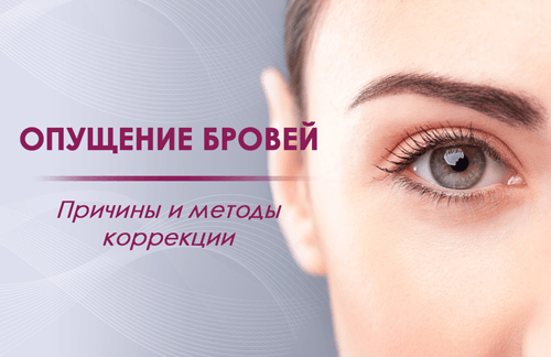 Опущение бровей - FloSal
