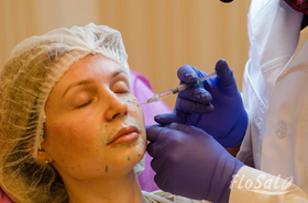 коррекция губ - FloSal