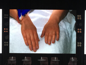 FloSal дебютировал на Sakura Esty Derm